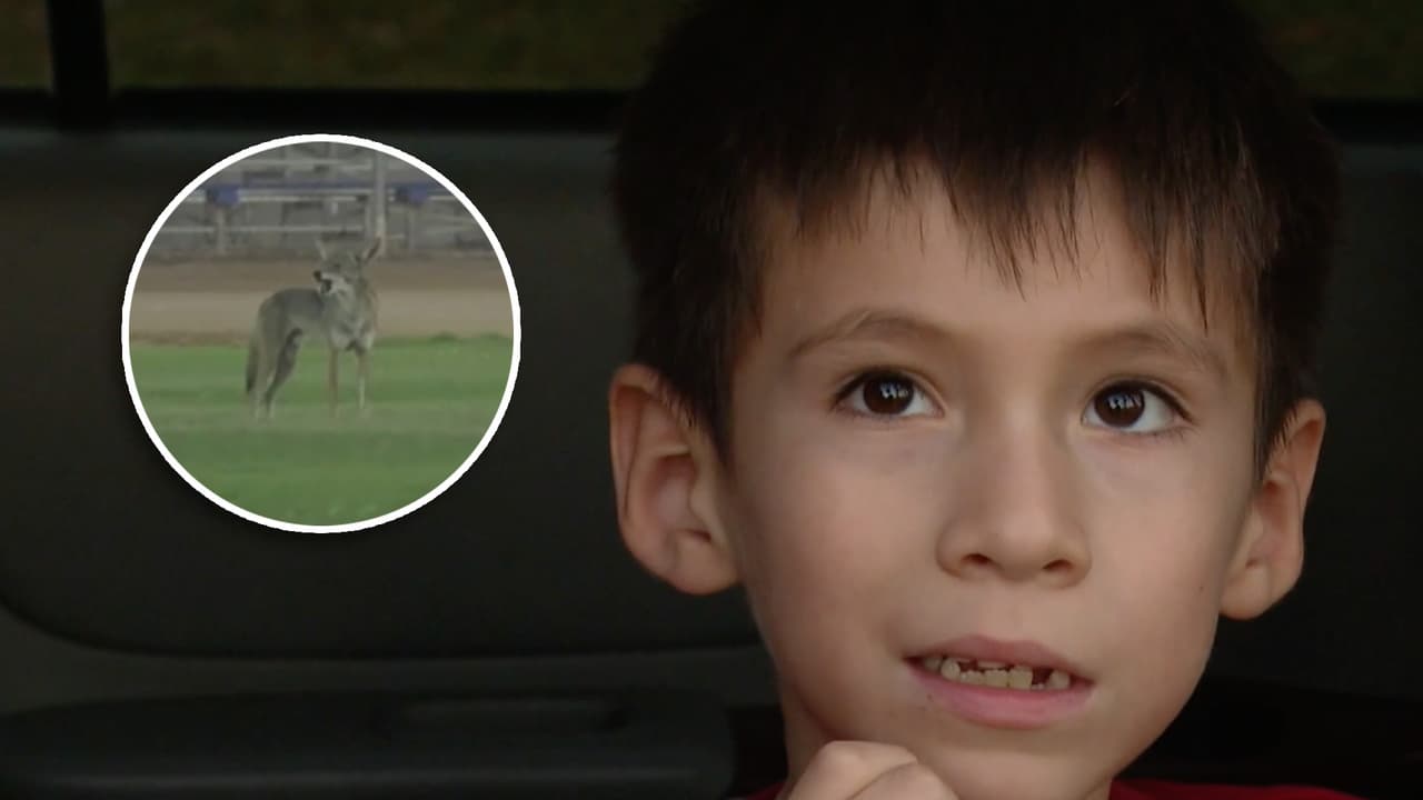 Coyote ataca a niño de 6 años en parque de Carson y le provoca graves heridas