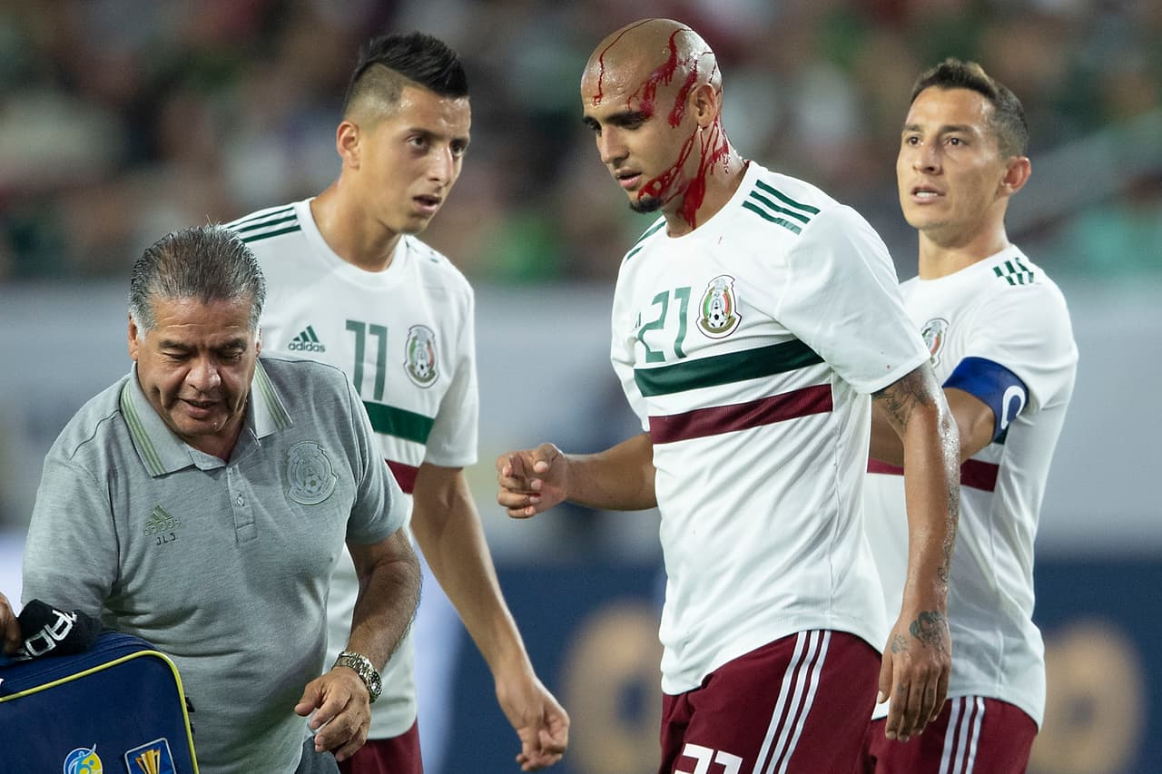 Al tener la cabeza a rape, un rodillazo de un futbolista haitiano, sin dolo, le ocasionó una escandalosa hemorragia. Pero luego de un par de minutos en el 'taller de reparaciones', regresó, con vendaje en la testa, para seguir jugando.