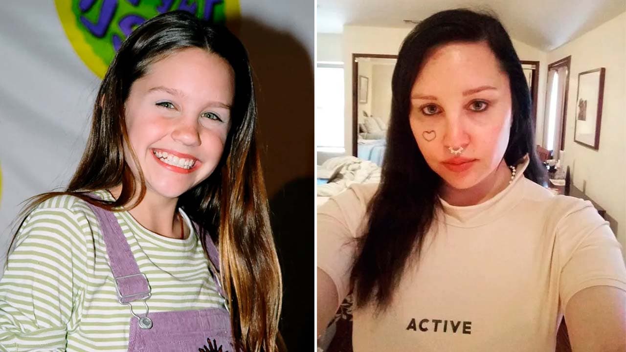 ¿Qué le pasó a Amanda Bynes en el rostro? Una extraña cirugía le cambió la cara