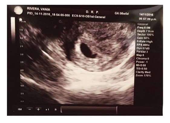 La actriz se emocionó mucho cuando supo que sería tía y compartió el ultrasonido de su sobrino para mostrar su felicidad a través de su cuenta de Instagram.