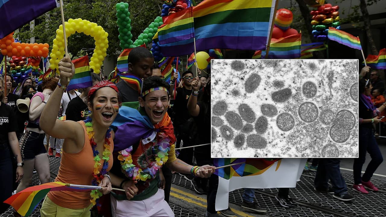 <b>¿Quiénes están bajo riesgo de contagios?</b>
<br>
<br>Actualmente, la comunidad LGBTQ+ ha sido la más afectada con esta enfermedad. No obstante, según el departamento de salud de Los Ángeles, esta puede ser contraida por cualquier persona al:
<br>Tocar las lesiones de viruela del mono en la piel de una persona contagiada 
<br>Tocar objetos contaminados, telas (ropa, ropa de cama, toallas) y superficies que han estado en contacto con alguien con viruela del mono. 
<br>Entrar en contacto con gotitas respiratorias o secreciones de los ojos, la nariz y la boca de una persona con viruela del mono.