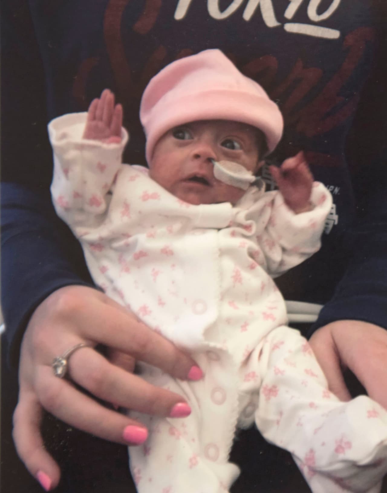 Le dijeron la cruel verdad: ningún bebé tan joven como Ava había sobrevivido a la cirugía.