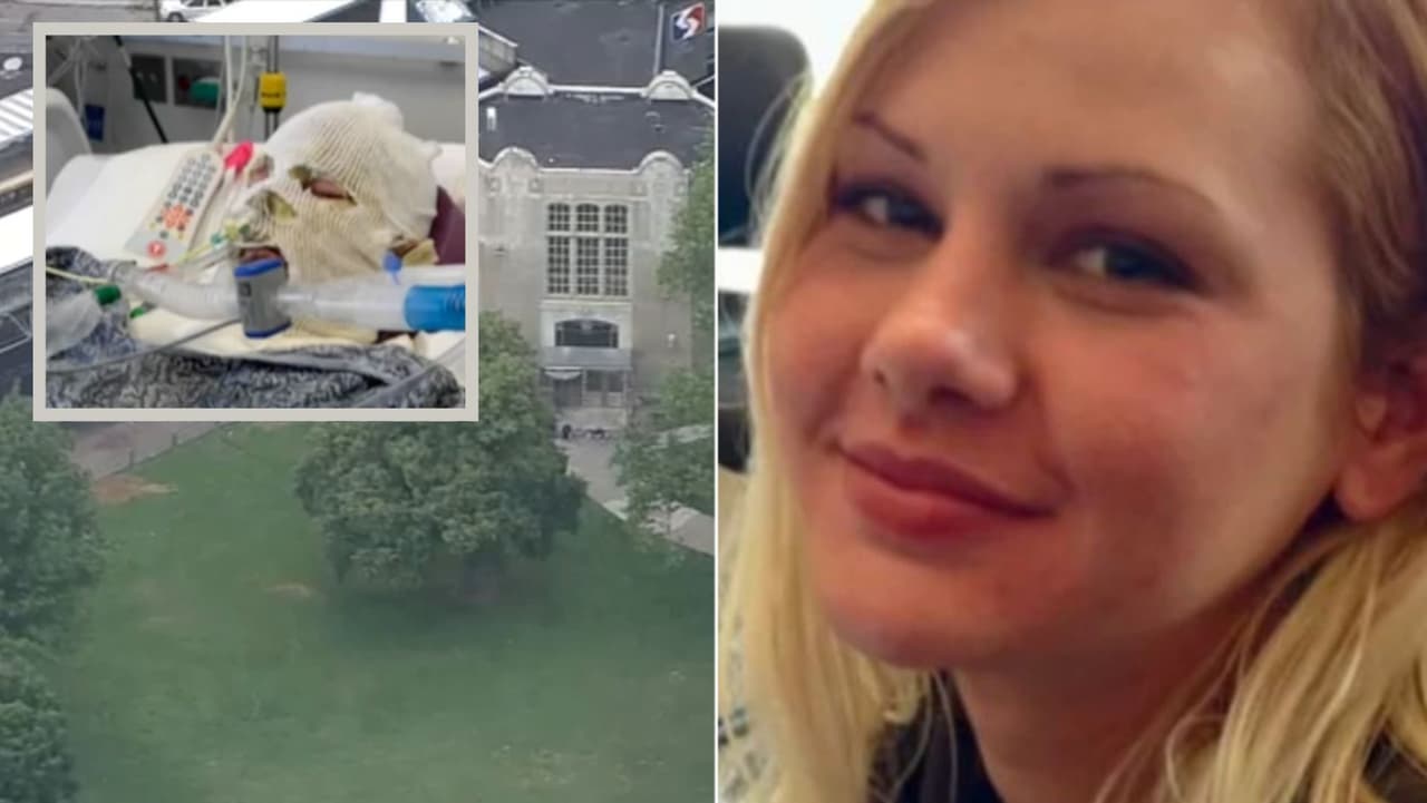 Autoridades buscan a los sospechosos de quemar intencionalmente a una mujer hispana en Kensington