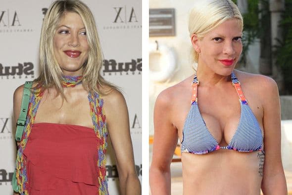 Tori Spelling se infló de la noche a la mañana.