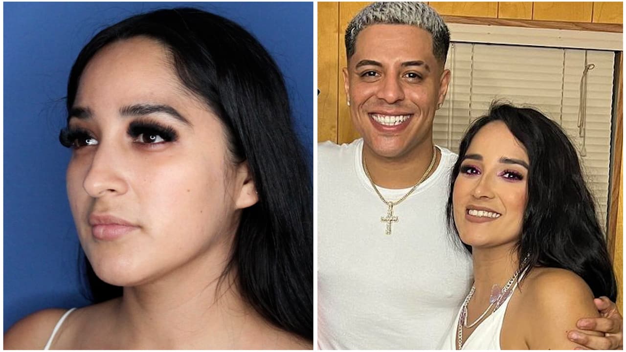 "La papada se fue": Daisy Anahy muestra el antes y después tras sus 'arreglitos' en el rostro