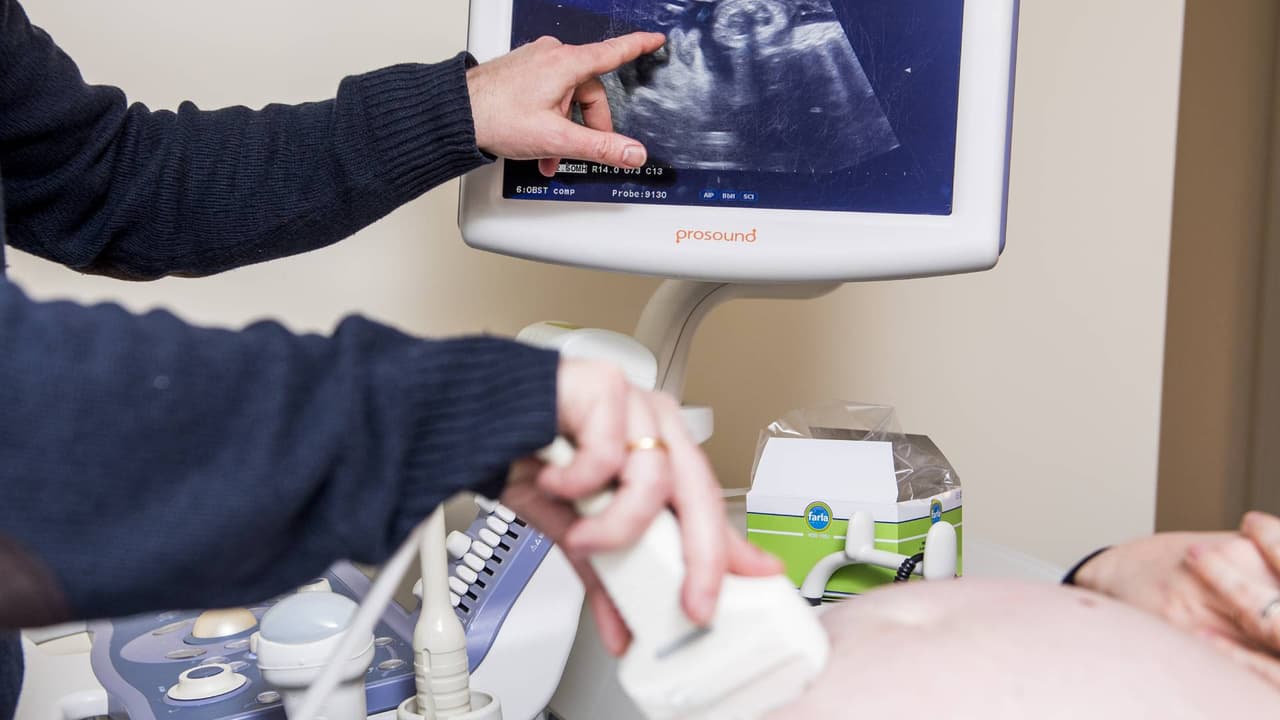 Una prohibición más estricta al aborto está a punto de entrar en vigor en Florida: estas son las excepciones