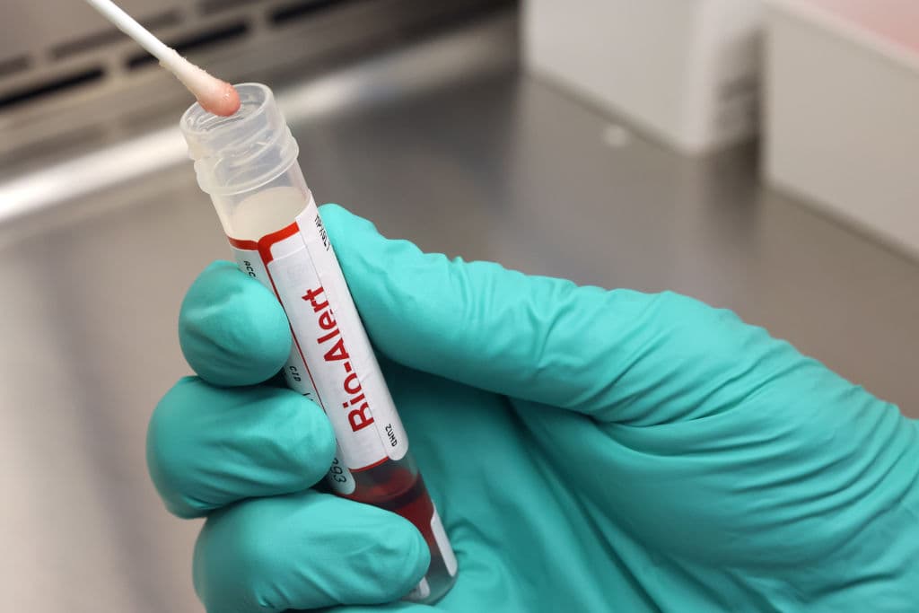 Ya son casi 3,000 infecciones por viruela del mono registradas en Estados Unidos