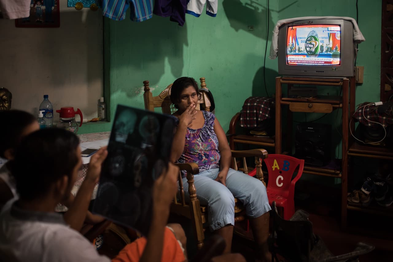 <b>“Mi hijo es prueba viviente de la salvajada”. </b>Ana María Martínez sabe que su hijo Juan Bosco Rivas Martínez está vivo de milagro. Un francotirador lo baleó en medio de los dos ojos. Su pronóstico era reservado, pero se recuperó, aunque debe vivir con la bala de AK-47 alojada en la cabeza. “Mi hijo es prueba viviente de la salvajada de la policía”, le dijo a Univision Noticias. La mujer ahora atiende a su hijo convaleciente en la pequeña vivienda ubicada en la ciudad de Masaya.