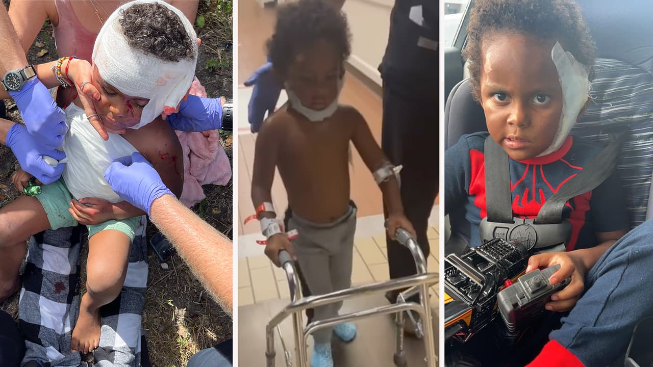 Sale del hospital el niño Carson de 4 años tras el ataque de un perro pitbull al suroeste de Houston