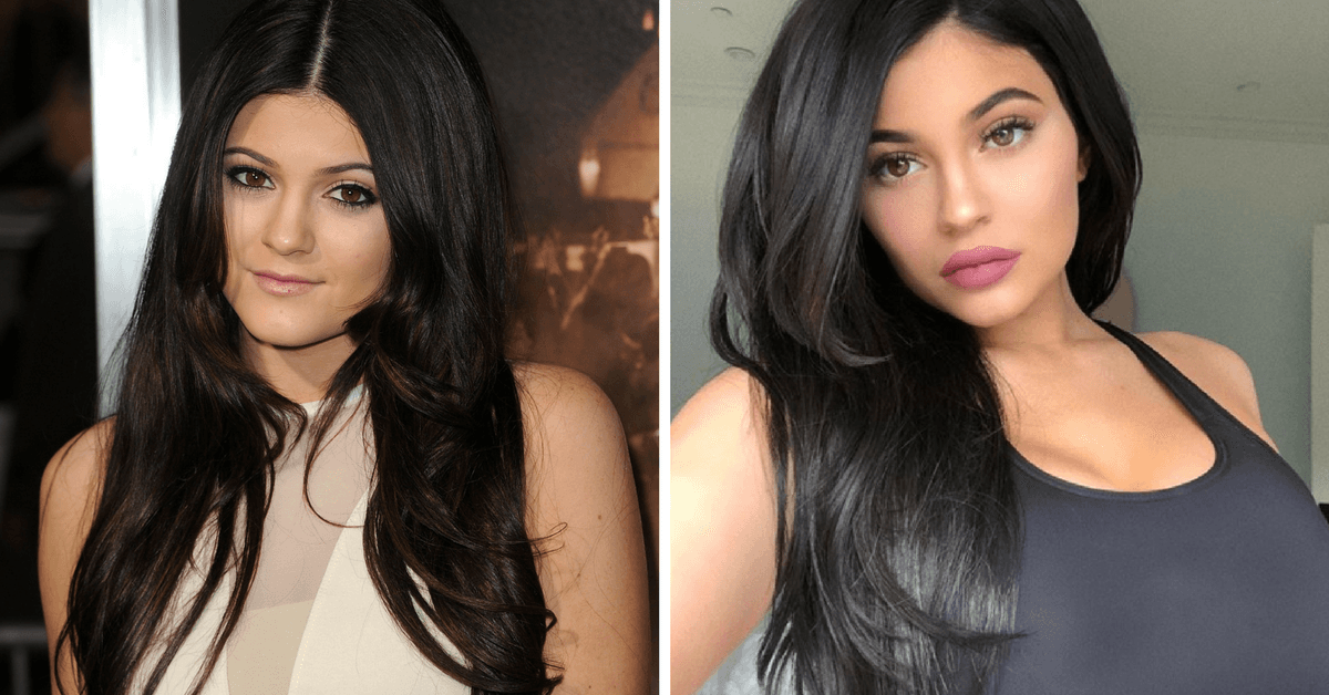 Así fue como Kylie Jenner convirtió su mayor inseguridad en un éxito multimillonario