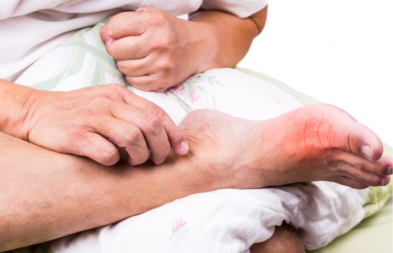 El dolor en las articulaciones puede indicar que tienes problemas con el ácido úrico