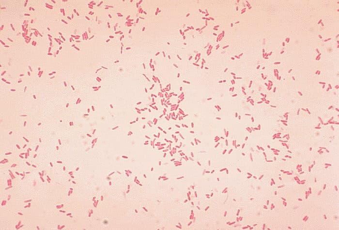 10 impresionantes fotografías de bacterias al microscopio