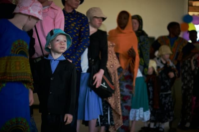Los albinos de Tanzania solo se sienten seguros en un lugar