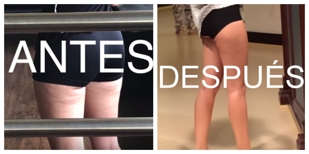 Bloguera redujo su celulitis en una semana y muestra el resultado: ¿qué hizo?