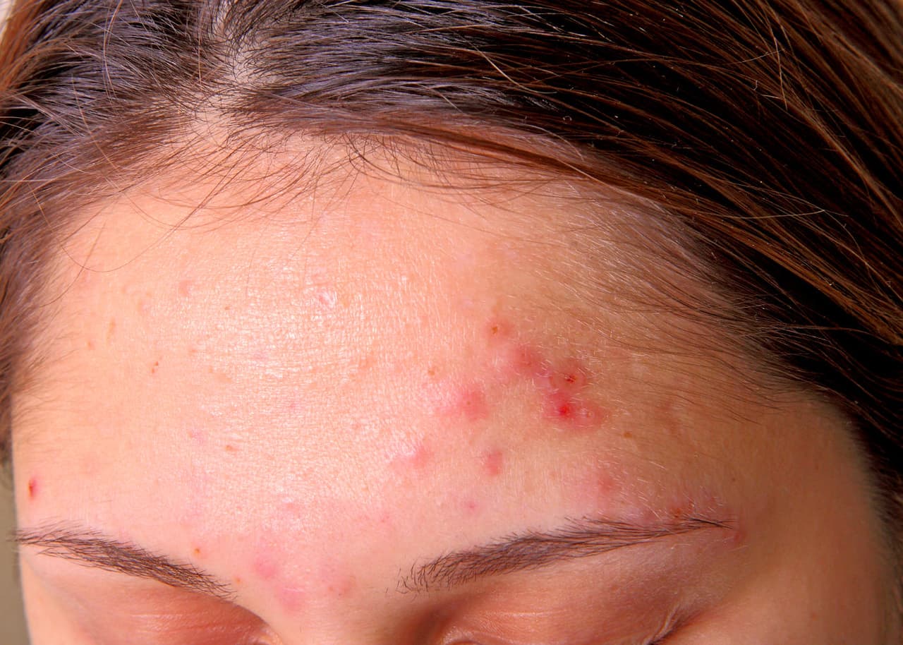 Cada parte del rostro puede dar señales de tu estado de salud: frente, mejillas, mentón y más