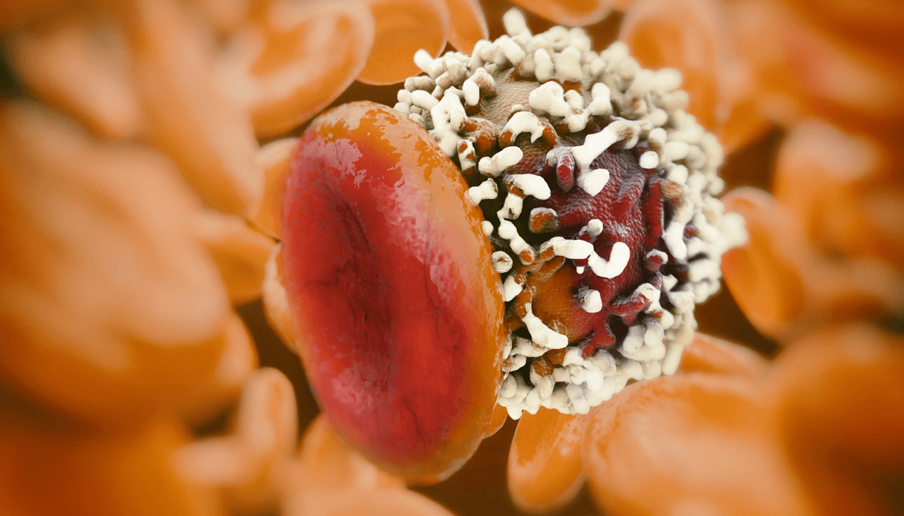 ¿Por qué en el hemisferio sur hay más casos de cáncer que en el norte? Oncólogo responde