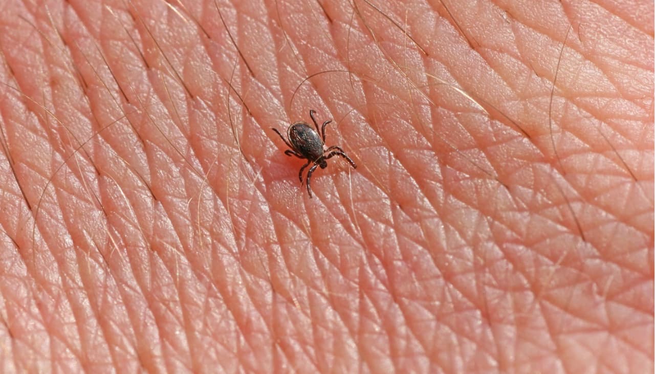 Si a ti o a tu hijo les aparece un círculo rojo en la piel, acude al médico de inmediato