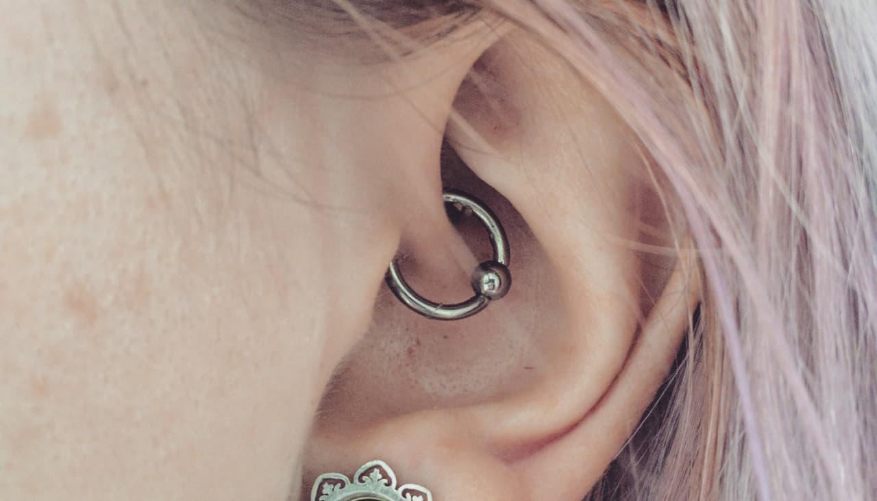 ¿Una perforación puede aliviar tus migrañas? La respuesta está en la acupuntura