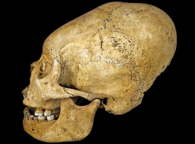 6 ejemplos de cráneos intencionalmente deformados alrededor del mundo