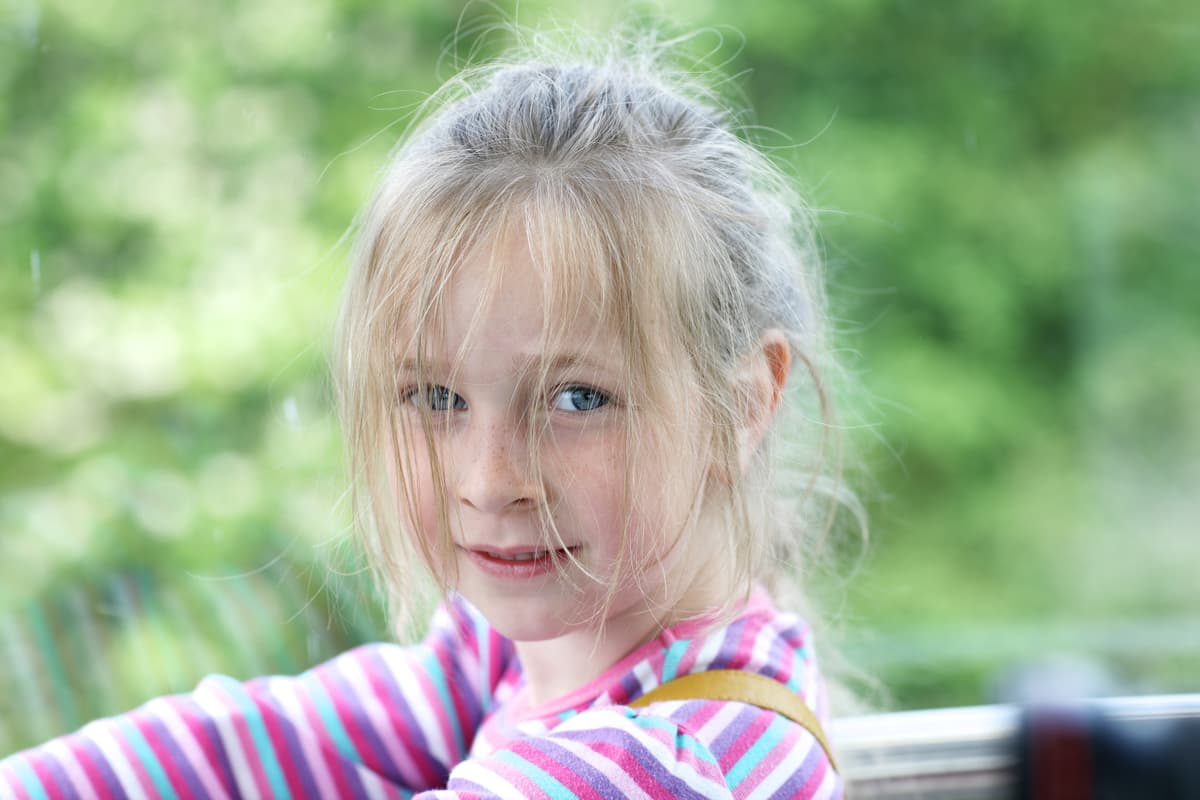 Si te es casi imposible cepillarte el cabello, quizá sufres de una condición genética