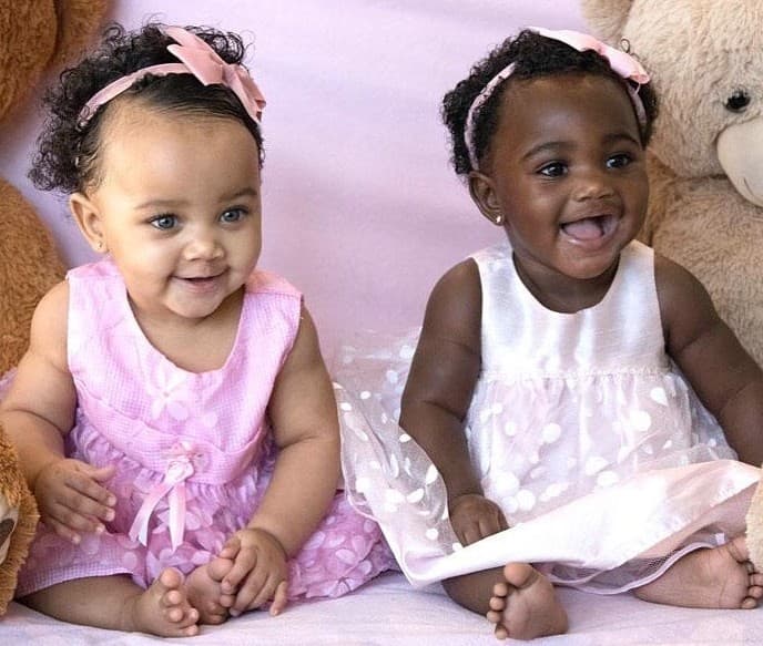 Gemelas nacen con distinto color de piel, ¿cómo es posible?