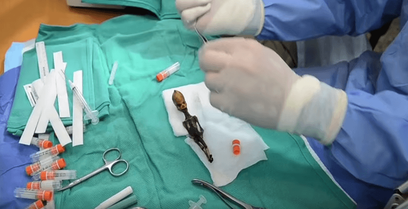 El humanoide de Atacama, ¿qué es y qué pasó con él?