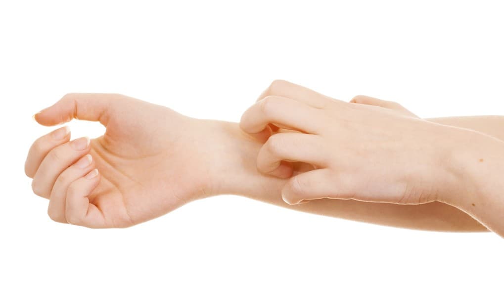 Alergia en las manos