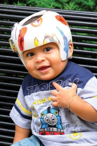 La mala postura de los bebés puede afectar el desarrollo de su cráneo