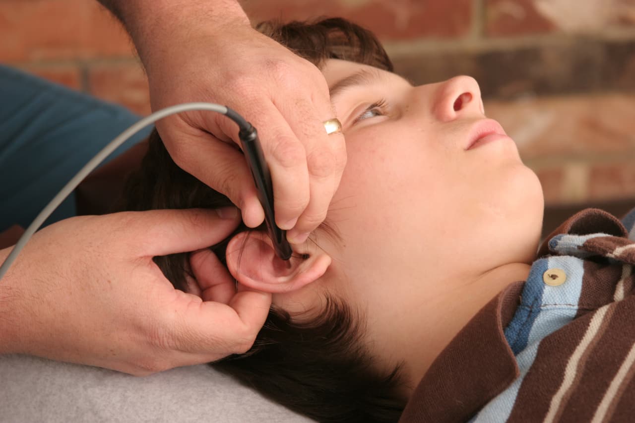 ¿Es seguro el uso de la acupuntura en niños?