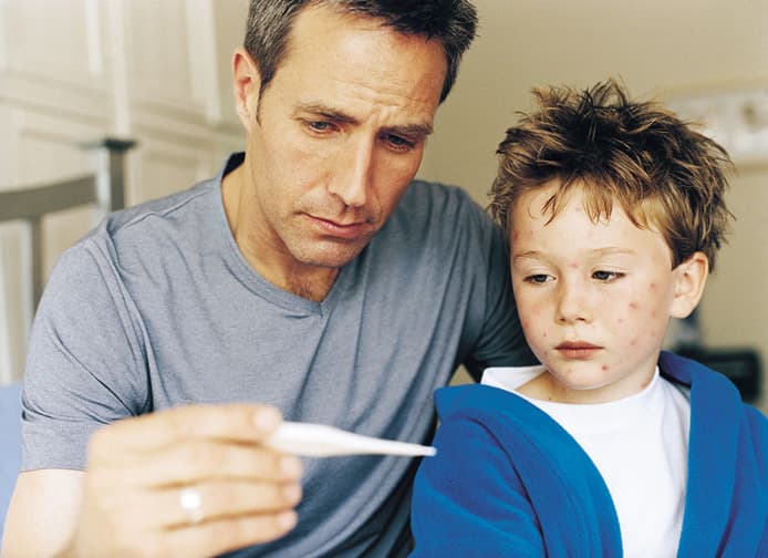 ¿Cómo tratar a los niños con varicela?