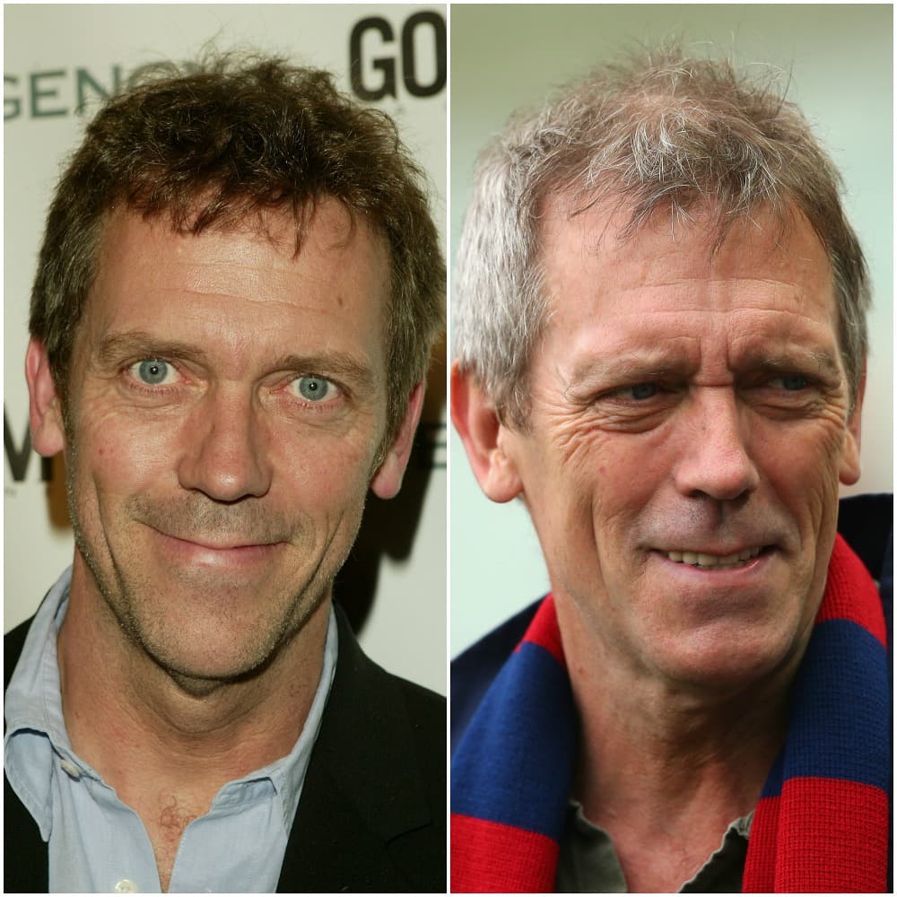 12 famosos que perdieron el pelo con el paso de los años