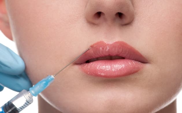 Aumento de labios: tres opciones posibles