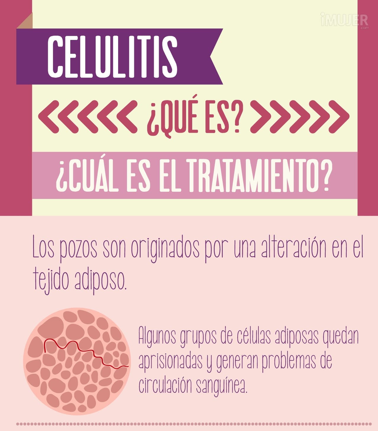 Infografía: Todo sobre la celulitis