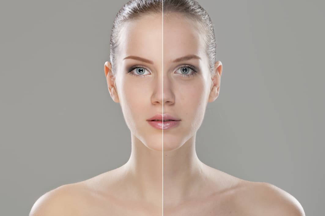 Soluciones para mejorar la piel escamada