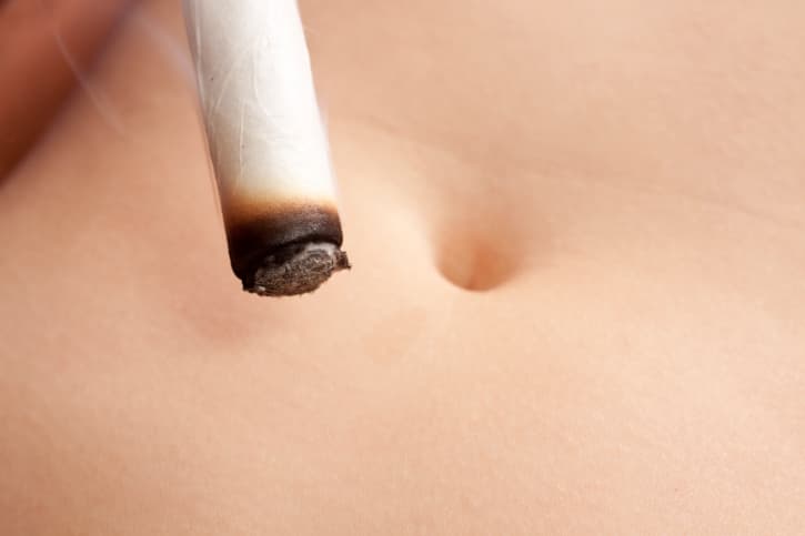 Historias alternativas: Historia de la Moxibustión