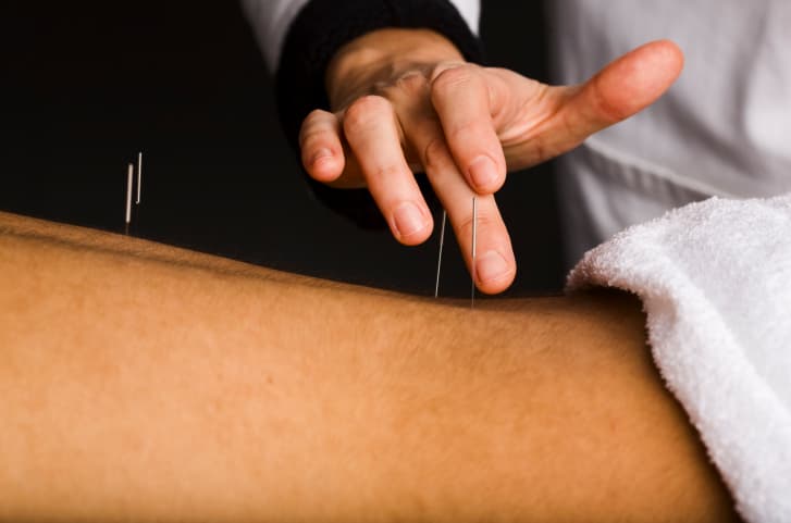 Puntos de acupuntura para bajar de peso