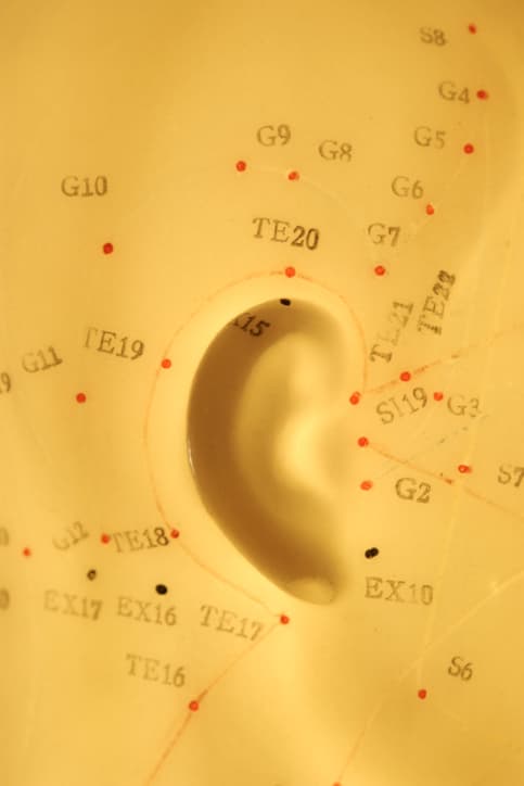 Auriculoterapia para bajar de peso