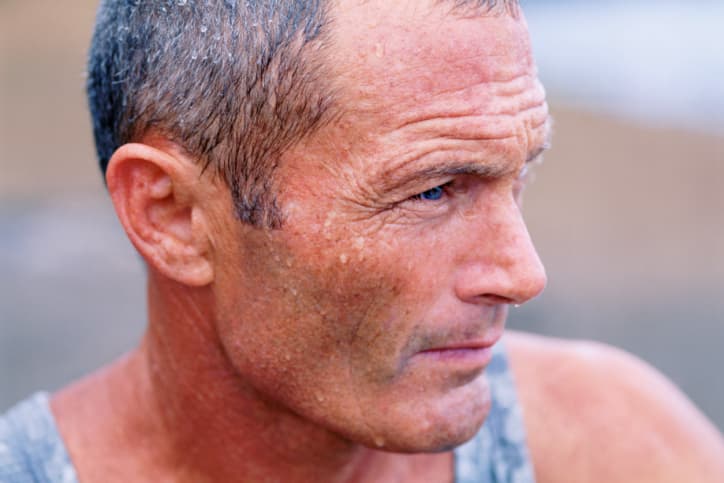 Esta condición congénita te impide sentir dolor y eso la vuelve muy peligrosa