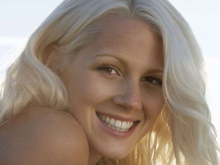 Cómo prevenir la caspa