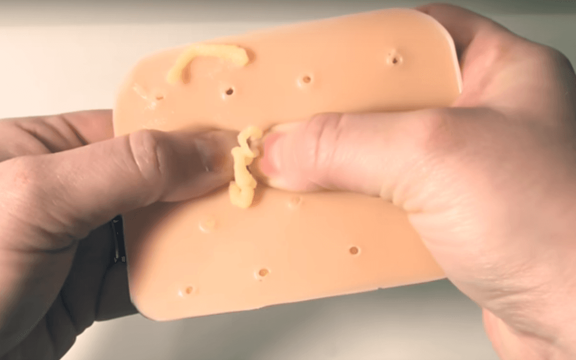 Un juguete para explotar puntos negros es un éxito: ¿por qué deberías dejar a tu rostro en paz?