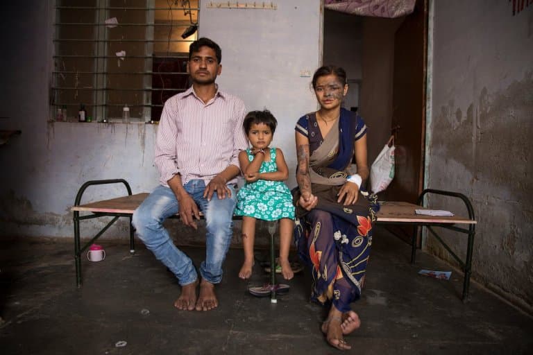 Su padre la atacó con ácido porque se enteró de su más cruel secreto: él era traficante de niñas