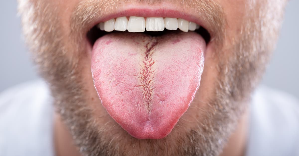 Detectar la diabetes con un análisis de saliva será posible, gracias a científicos mexicanos