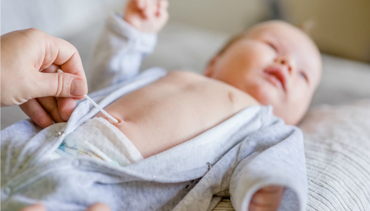 El ombligo de mi bebé está hacia afuera: ¿Debo ponerle algo? ¿Se puede romper? Pediatra explica