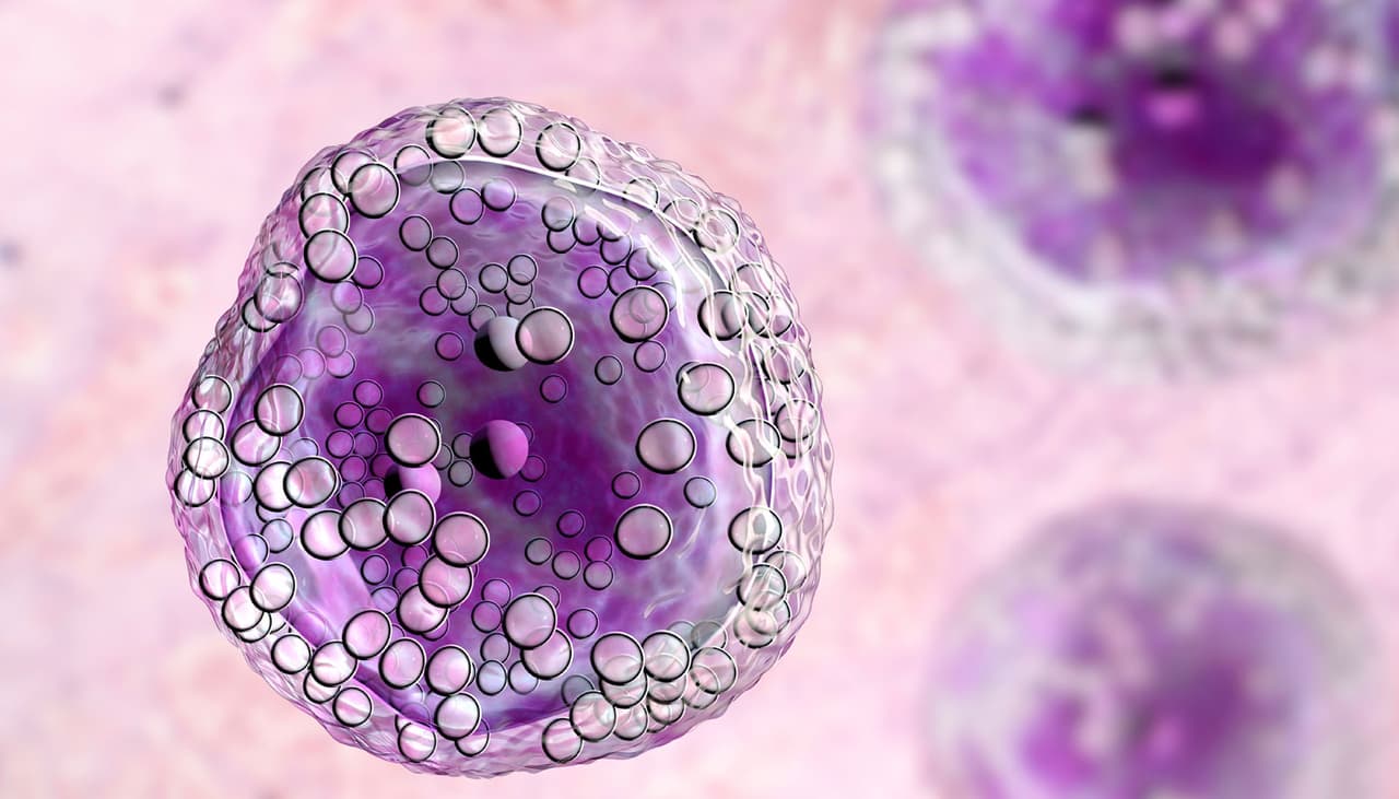 La inflamación en el cuello puede ser un síntomas de cáncer en el sistema linfático