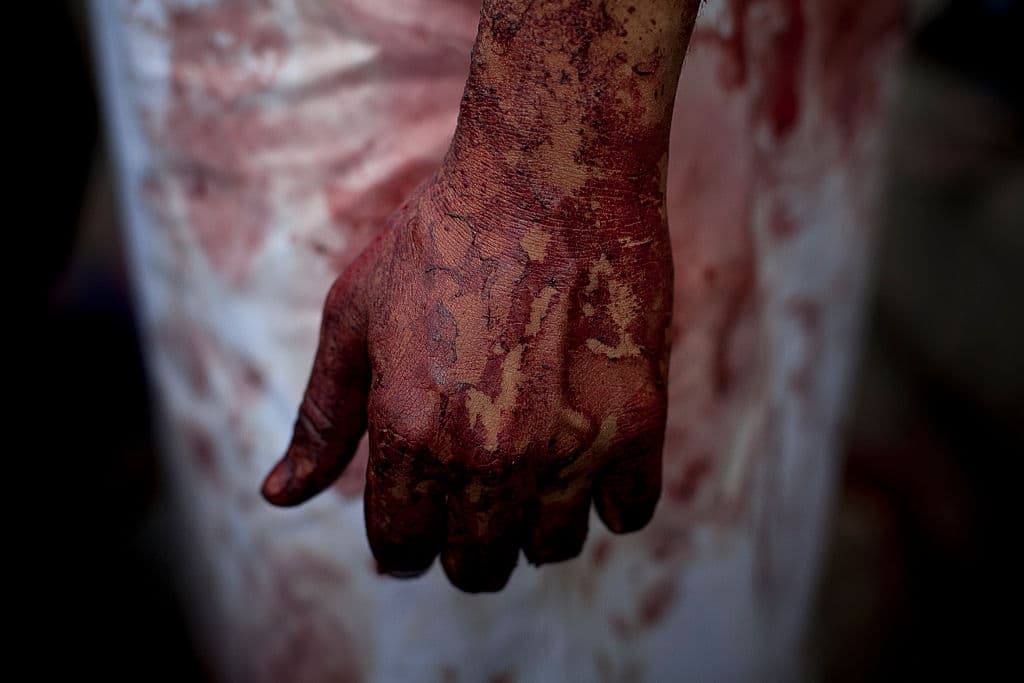 Médicos que atienden a víctimas de armas de fuego suben FOTOS impactantes: y tienen razón