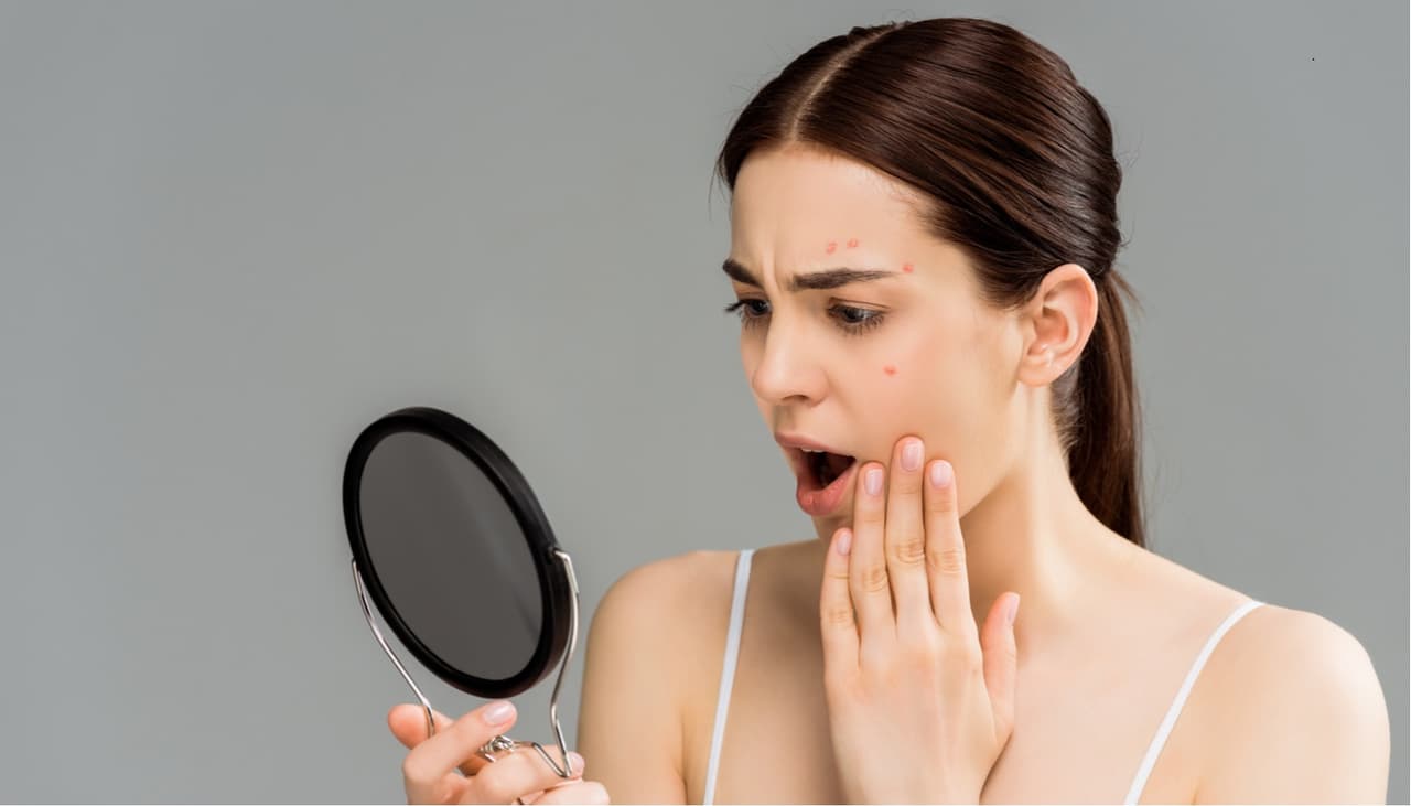 El aceite esencial de árbol de té es excelente contra el acné: te decimos cómo usarlo 