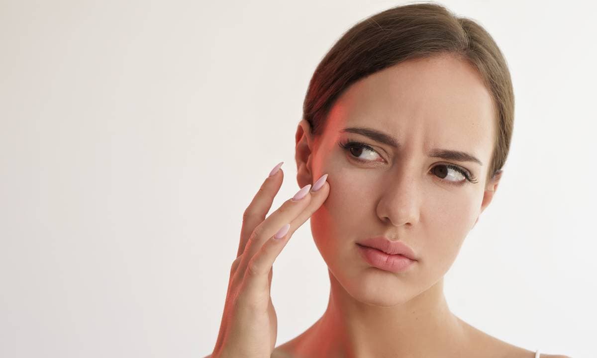 ¿Te salen arañitas en el rostro? Te decimos por qué aparecen y cómo eliminarlas