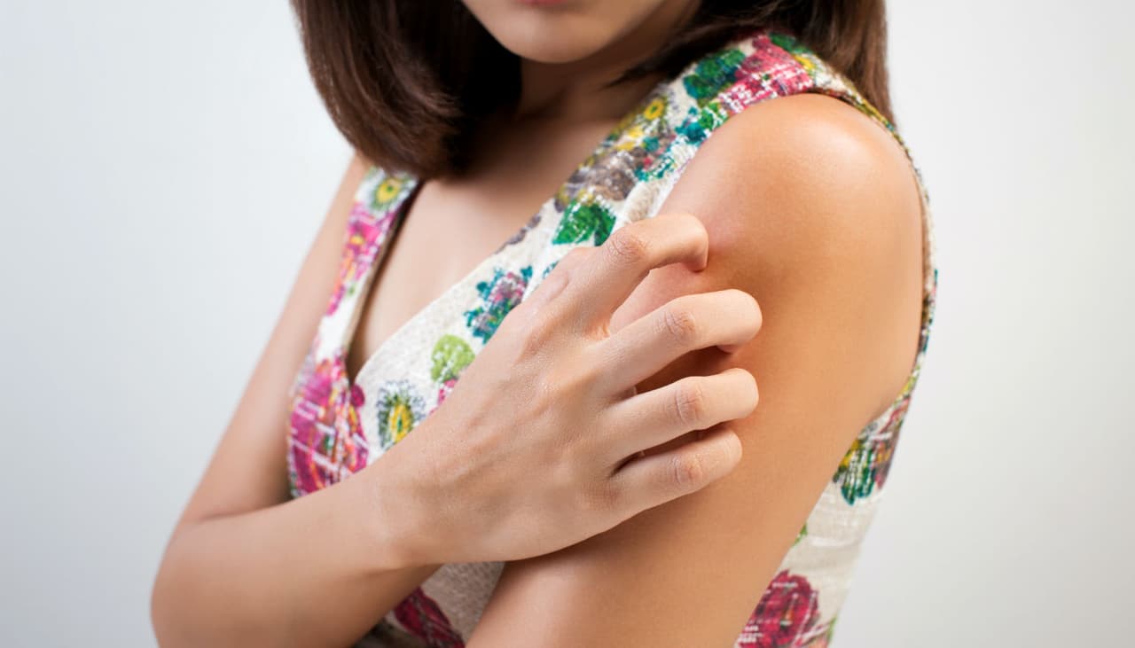 ¿Los mosquitos solo te pican a ti? La persecución es real y tiene motivos para serlo