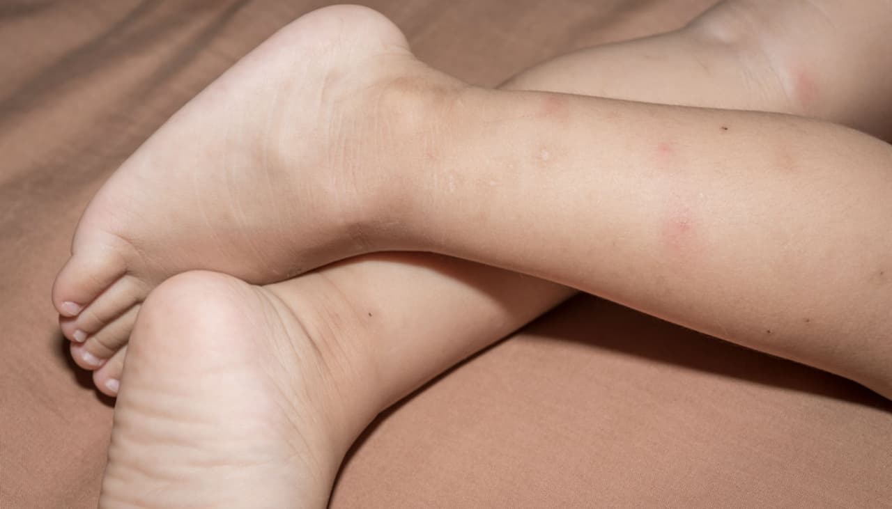 ¿Tu hijo se despierta con dolor por las noches? Podría sufrir "dolor del crecimiento"