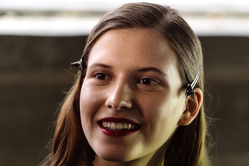 Esto es todo lo que necesitas para deshacerte del acné para siempre